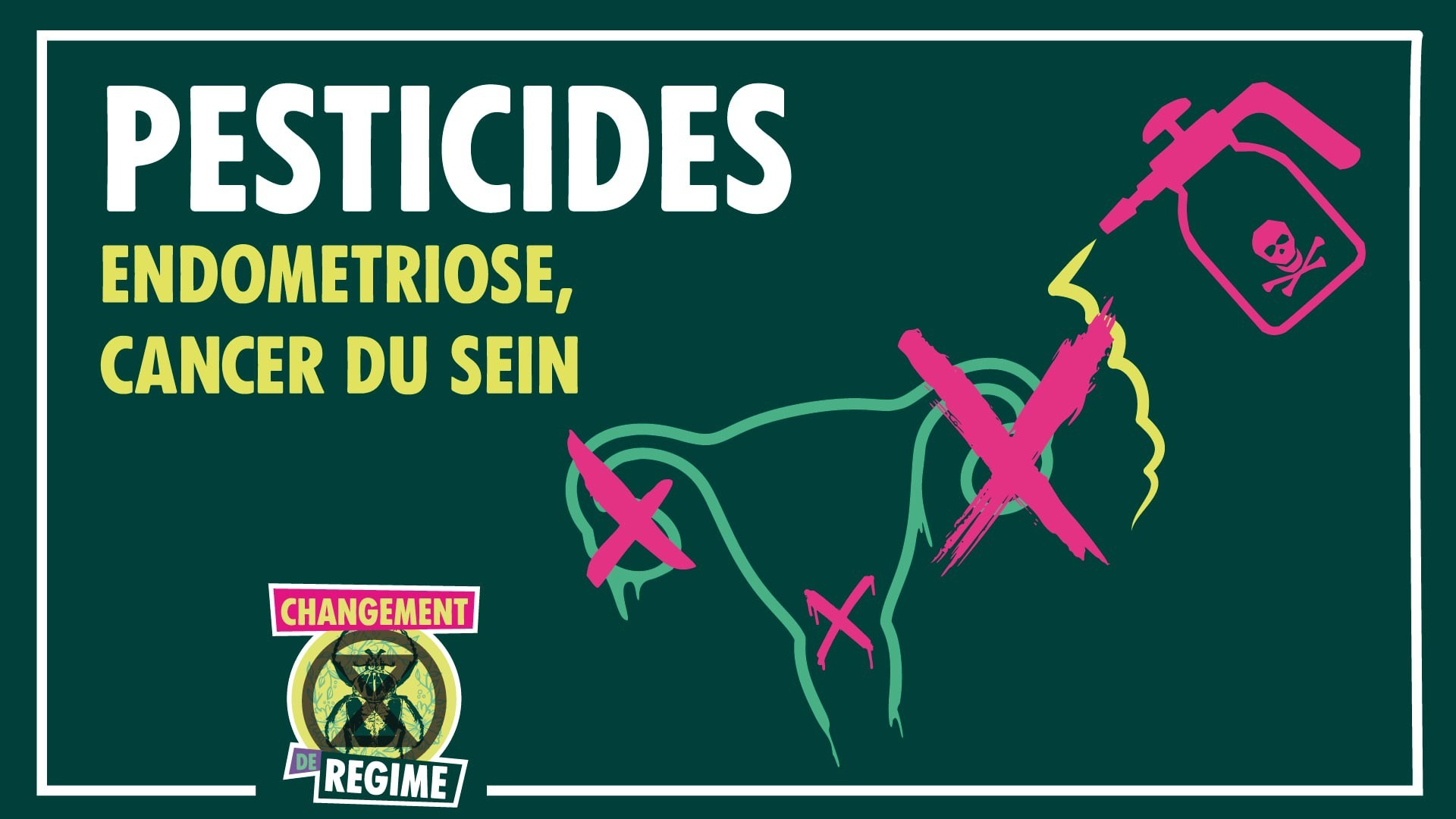 illustration article endometriose cancer du sein